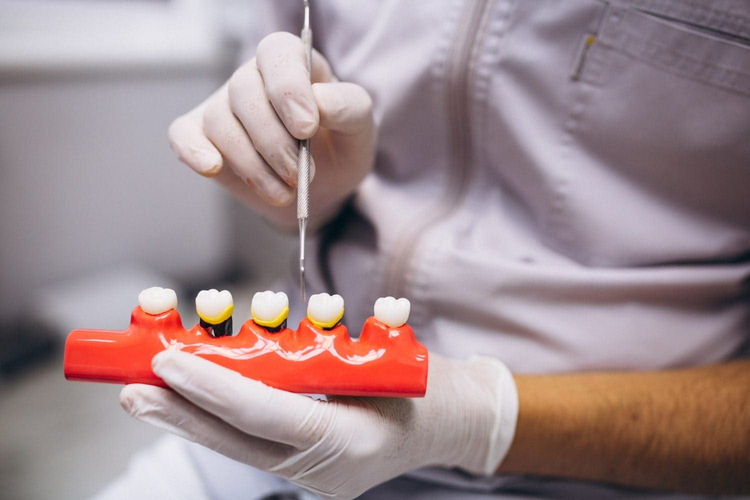 dental-bridge